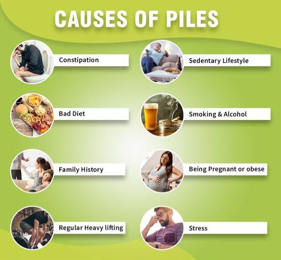 Causes of piles